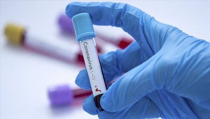 Биолог рассказала, почему тесты на коронавирус могут давать ошибочный результат