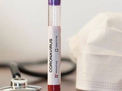 Число заразившихся коронавирусом в Армении увеличилось на 79