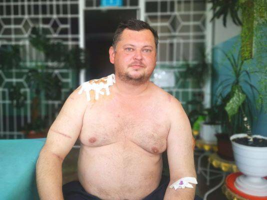 Обстрелы со стороны ВСУ: житель ДНР получил второе ранение за два года
