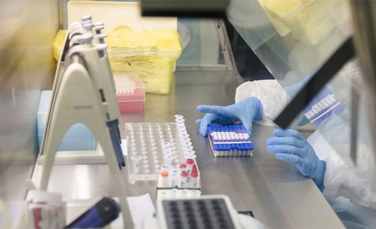 В Москве проведут массовое бесплатное тестирование на антитела к коронавирусу. Как оно будет проходить