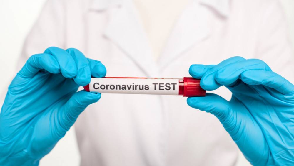 За минувшие сутки в Казахстане выявили 154 случая коронавируса