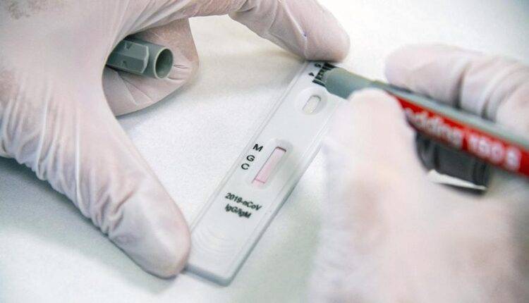 Российский тест на антитела к COVID-19 признан одним из самых точных в мире