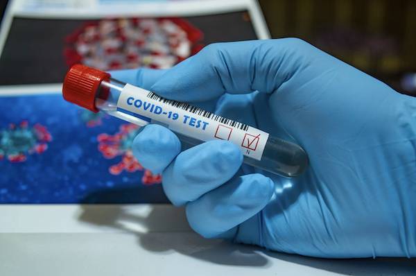 Почти 10,6 тыс. новых случаев коронавируса выявили в России