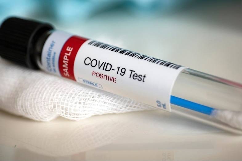 Глава ФМБА назвала возможные причины повторного выявления коронавируса