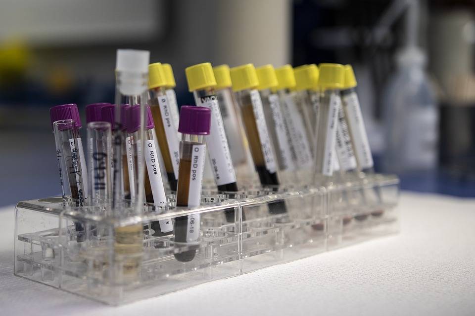 Какие штрафы и последствия за отказ от теста на коронавирус — рассказали в МВД