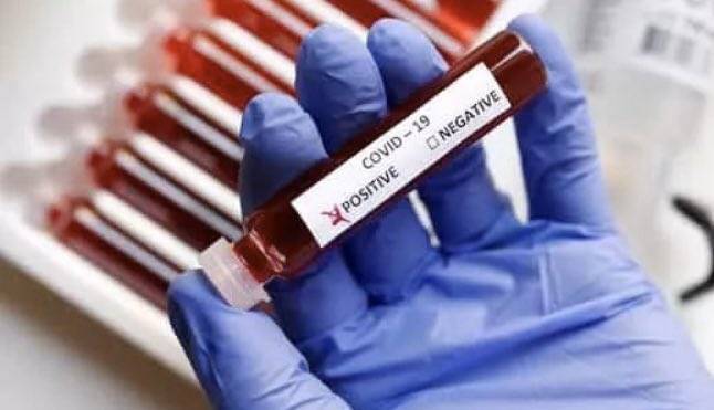 Свыше 25 тысяч случаев коронавируса выявили в США за сутки