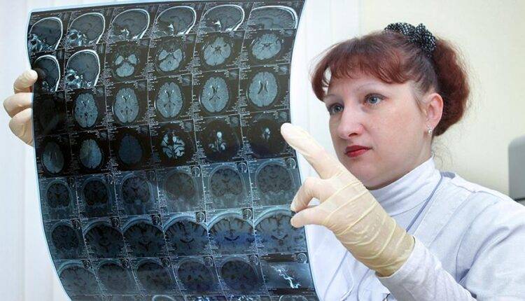 Российские ученые нашли способ лечить опухоли мозга иммунотерапией
