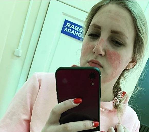 Во Владимирской области медсестра получила ожог лица после использования маски