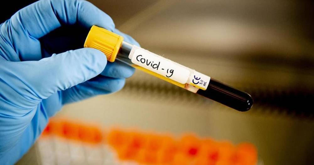 Тест на антитела к COVID в ближайшее время сможет сдать каждый москвич