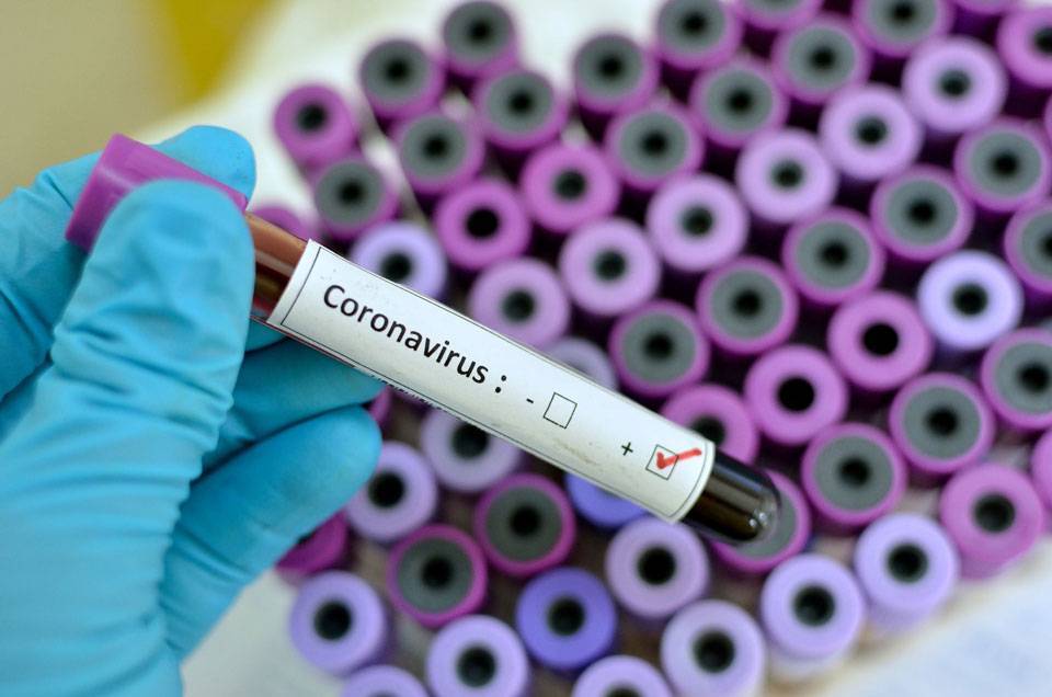 В Грузии зафиксировано 12 новых случаев коронавирусной инфекции