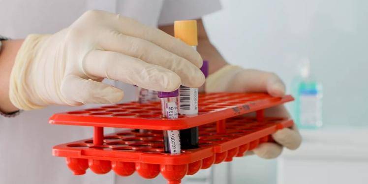 Собянин: любой москвич сможет сдать тест на антитела к COVID-19 в ближайшие 2-3 недели