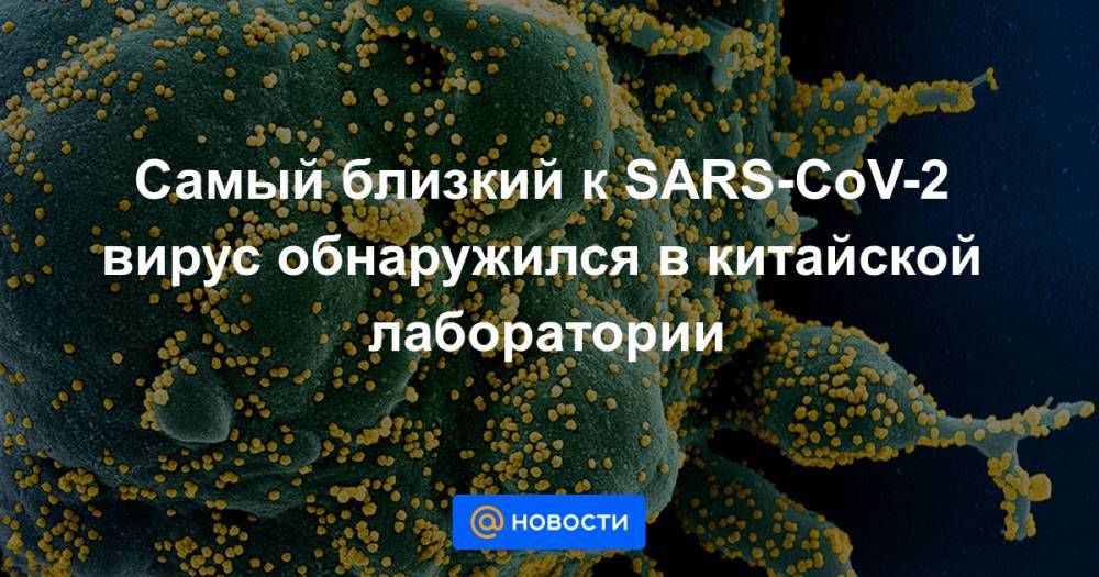 Самый близкий к SARS-CoV-2 вирус обнаружился в китайской лаборатории