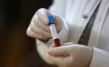 Скворцова: больше всего заразившихся коронавирусом среди людей со II группой крови
