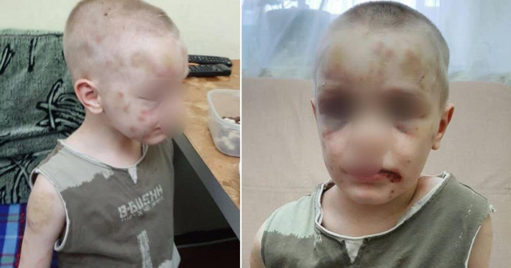 Истязавшей 6-летнего сына в Новороссийске матери предъявили обвинения