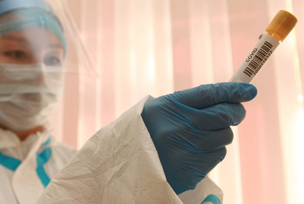 Более 7,5 миллиона тестов на коронавирус провели в России