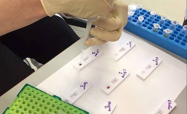 В минских поликлиниках уже есть экспресс-тесты на коронавирус. Можно ли сделать платно?
