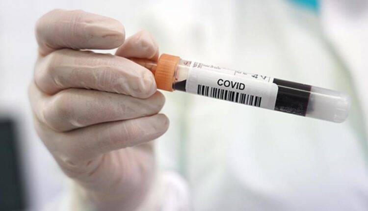 В Бразилии разработали первый в мире генетический тест на коронавирус