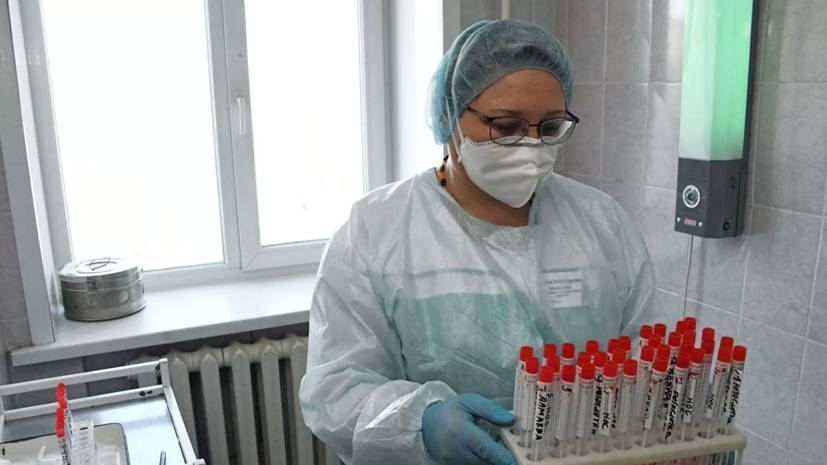 В Новосибирской области выявили 83 новых случая коронавируса
