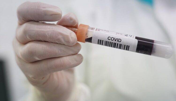 Центр CMD запустил тестирование на антитела к коронавирусу