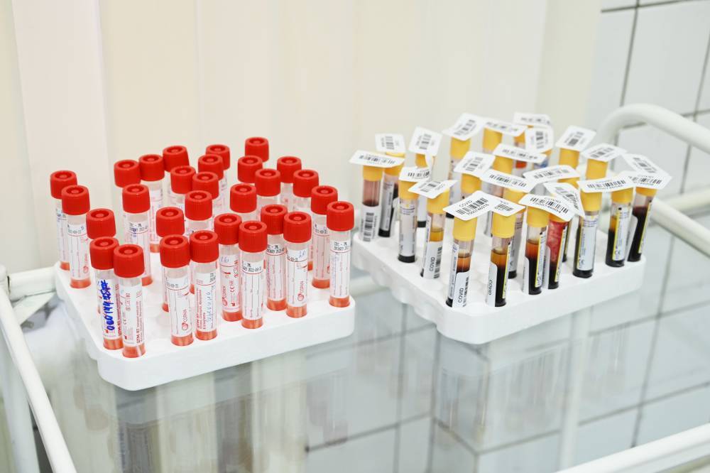 Появились первые результаты тестирования российской вакцины от COVID-19