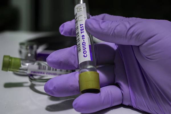 В России провели более 9,1 млн тестов на коронавирус