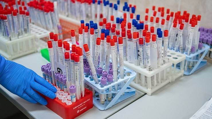 Во Львове запустили ИФА-тестирование на антитела к коронавирусу сотрудников больницы скорой помощи