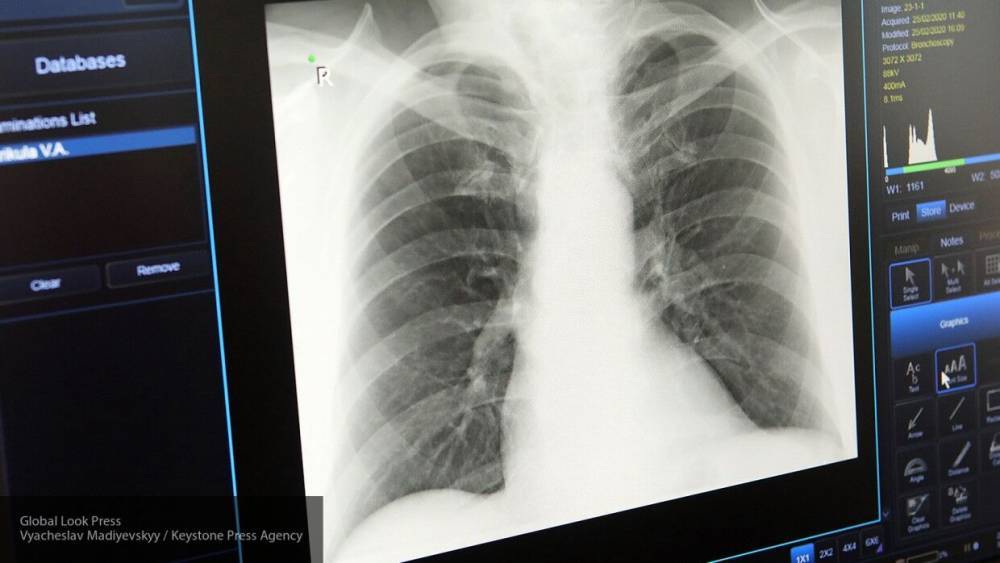 Больницы Ленобласти получили современные рентген-аппараты