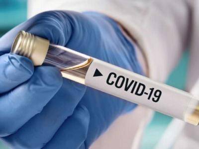 Уже 7774: В Армении за сутки зарегистрировано 373 новых случая заражения коронавирусом