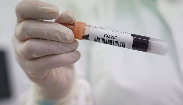 Ученые обнаружили странную особенность коронавируса