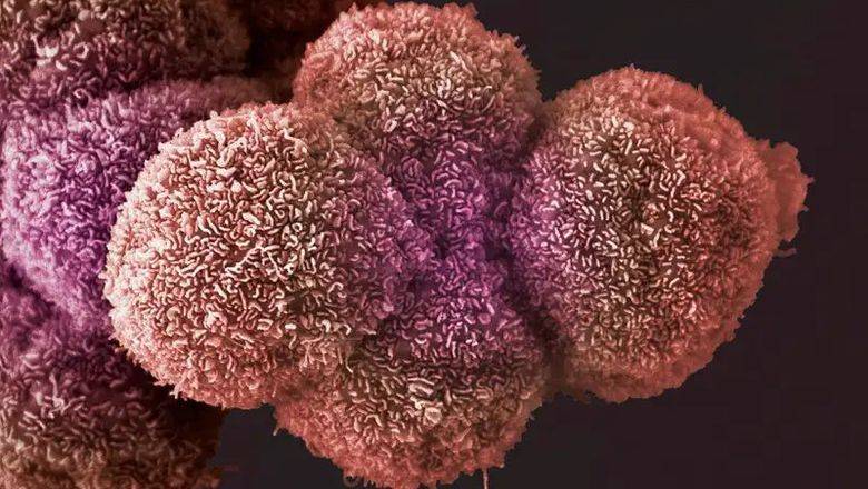 Исследователи обнаружили бактерии во всех видах раковых опухолей