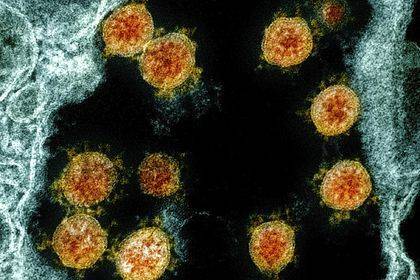 Определена новая смертельная опасность коронавируса - usa.one - США - Англия - Испания - Канада