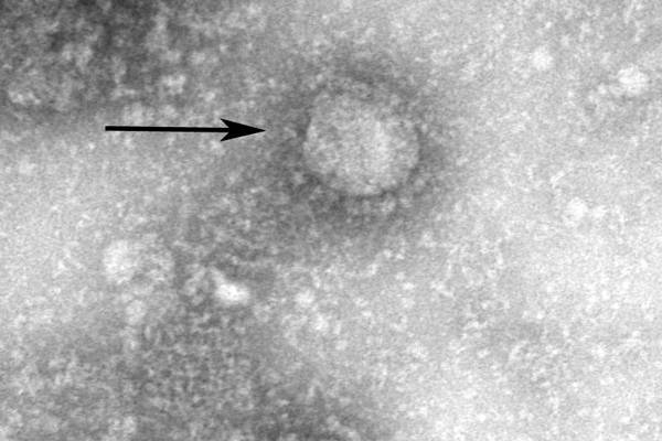 Ученые признали, что коронавирус возник на китайском рынке