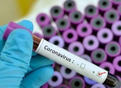 Уже 8927: В Армении за сутки зарегистрирован 251 новый случай заражения коронавирусом