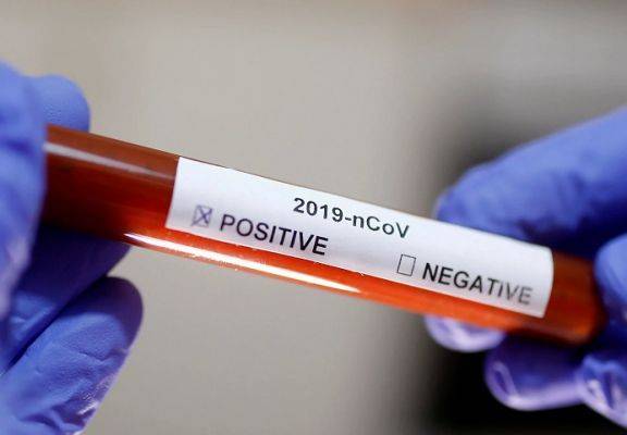 В России за сутки выявлено 8952 новых случая заражения коронавирусом