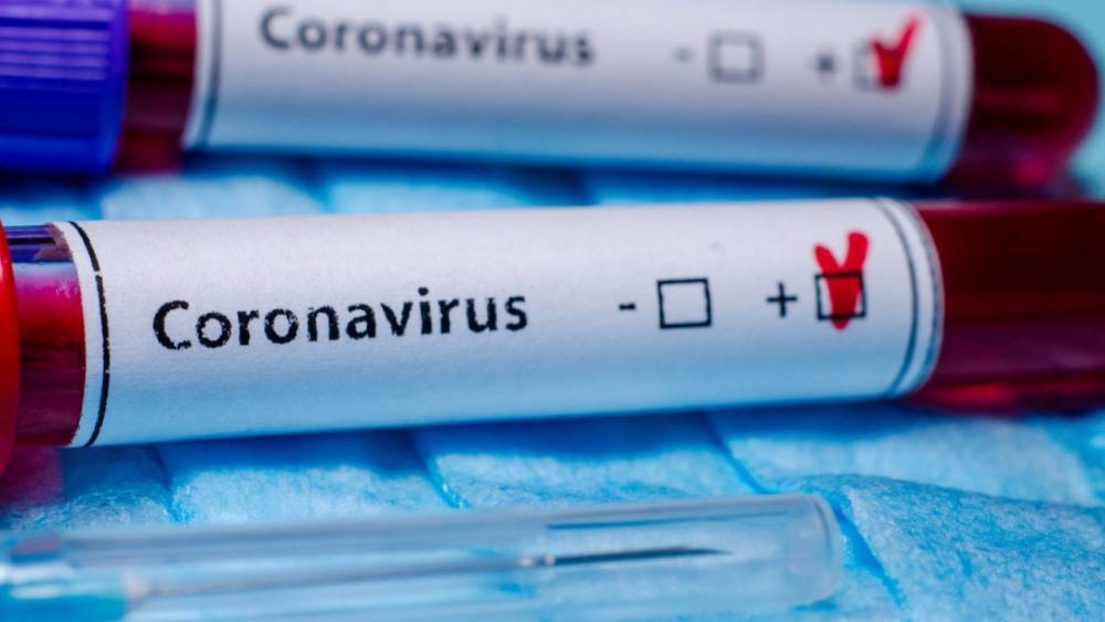 Еще 476 человек заразились коронавирусом в Казахстане