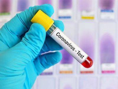 СМИ: Иранские ученые разработали тест-систему для выявления коронавируса за 55 минут