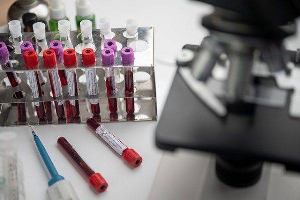 Сроки тестирования на коронавирус в Петербурге могут увеличить