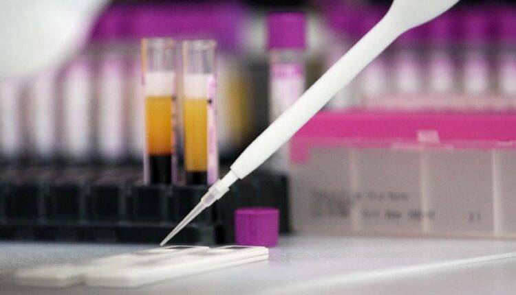 В России зарегистрировали две тест-системы на антитела к коронавирусу