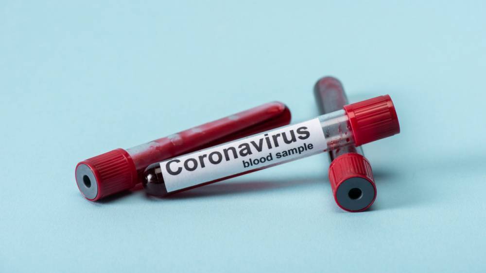 Число зараженных коронавирусом в Казахстане достигло 4160