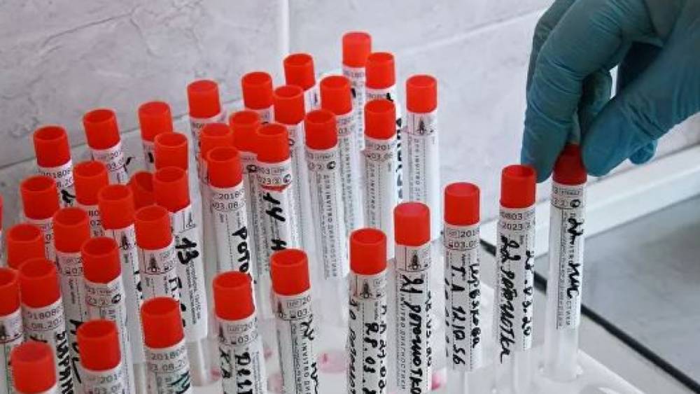 Еще 57 человек выздоровели от коронавируса в Казахстане