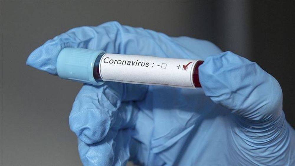 Выявлено 76 случаев заражения коронавирусом, вылечились 28 человек