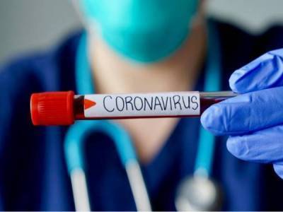 «Рекорд» за «рекордом»: В Армении за сутки зарегистрировано 163 новых случая заражения коронавирусом
