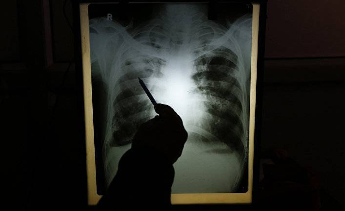 The Guardian (Великобритания): из-за карантинов 1,4 миллиона умрут от туберкулеза