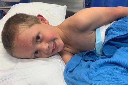 Пятилетний мальчик спас сестру от агрессивного кенгуру и получил тяжелые травмы