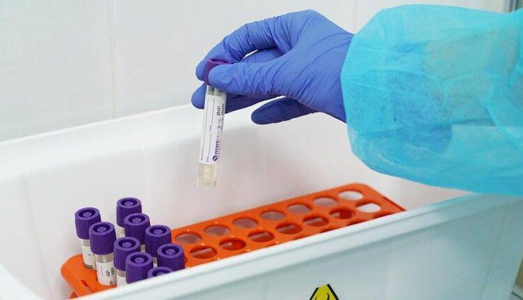 РФПИ и JBIC договорились об инвестициях в тест-системы на коронавирус