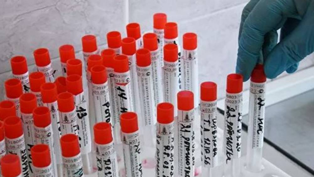 Еще 64 человек выздоровели от коронавируса в Казахстане