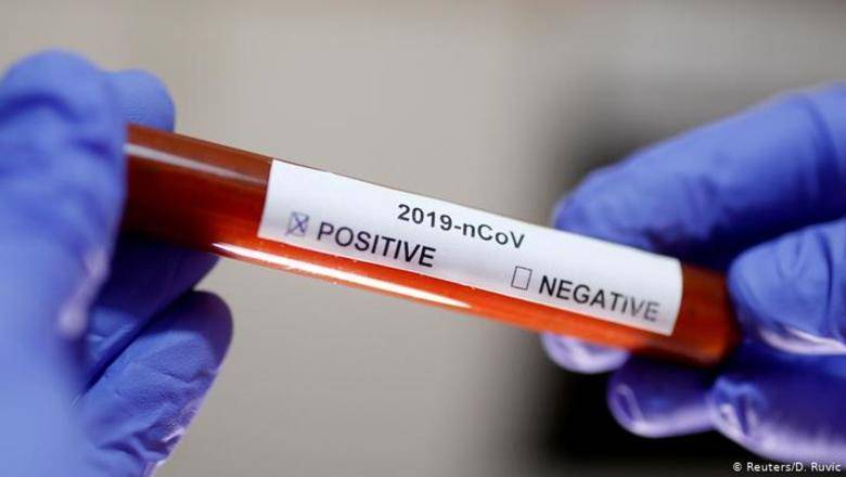 Российские тесты на коронавирус назвали "крайне неточными"