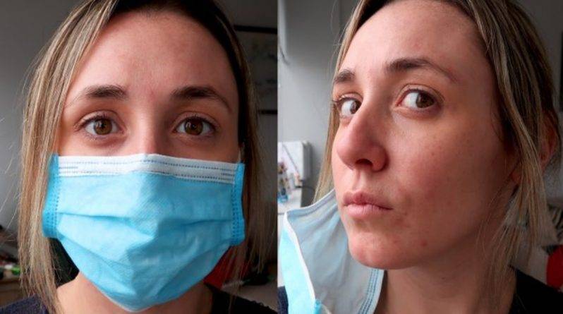 Пандемию коронавируса связывают с новым побочным эффектом из-за использования масок для лица