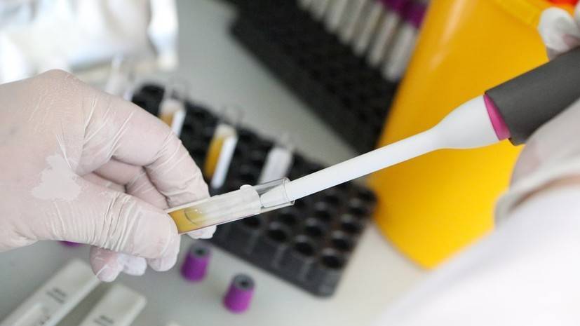 В Москве применят новый метод тестирования на коронавирус