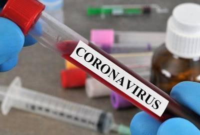 Number of confirmed COVID-19 cases reaches 3,175 in Armenia, 1 new death reported - news.am - Армения